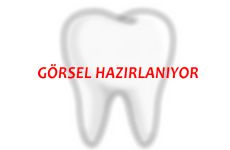 LAZER ÜSTÜ PORSELEN